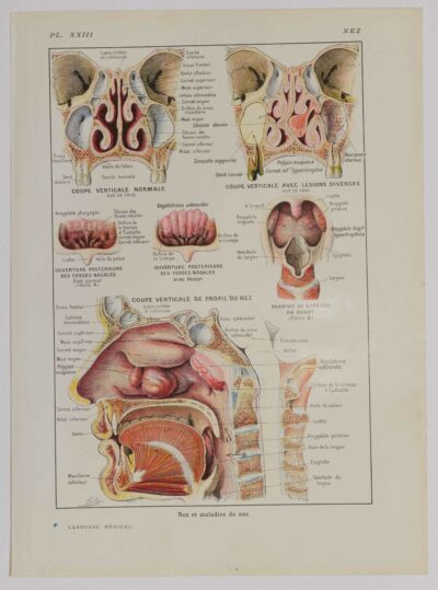 118A5933-medical-anatomie-nez Nez, planche anatomique 1924