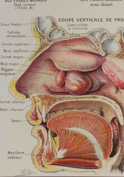 118A5933-medical-anatomie-nez Nez, planche anatomique 1924