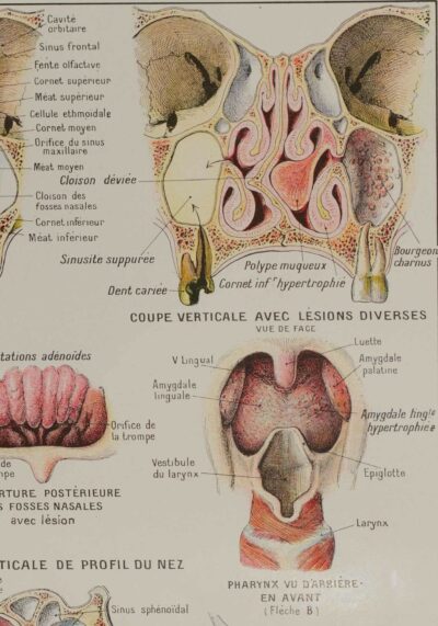 118A5933-medical-anatomie-nez Nez, planche anatomique 1924