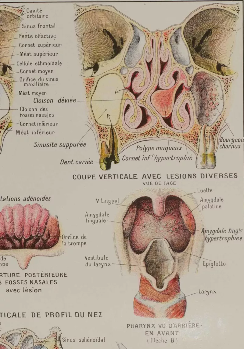 118A5933-medical-anatomie-nez Nez, planche anatomique 1924