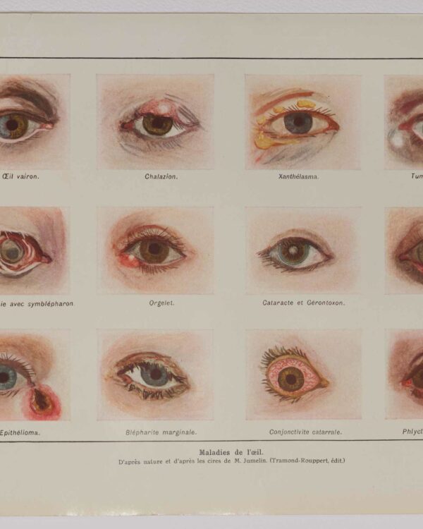 Maladies de l’œil, planche médicale 1924